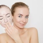 Akne İlacını Uzman Denetiminde Kullanın!